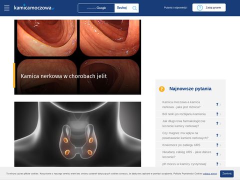 Kamicamoczowa.pl badanie składu kamieni