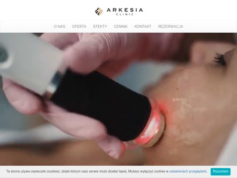 Arkesia.pl - depilacja laserowa